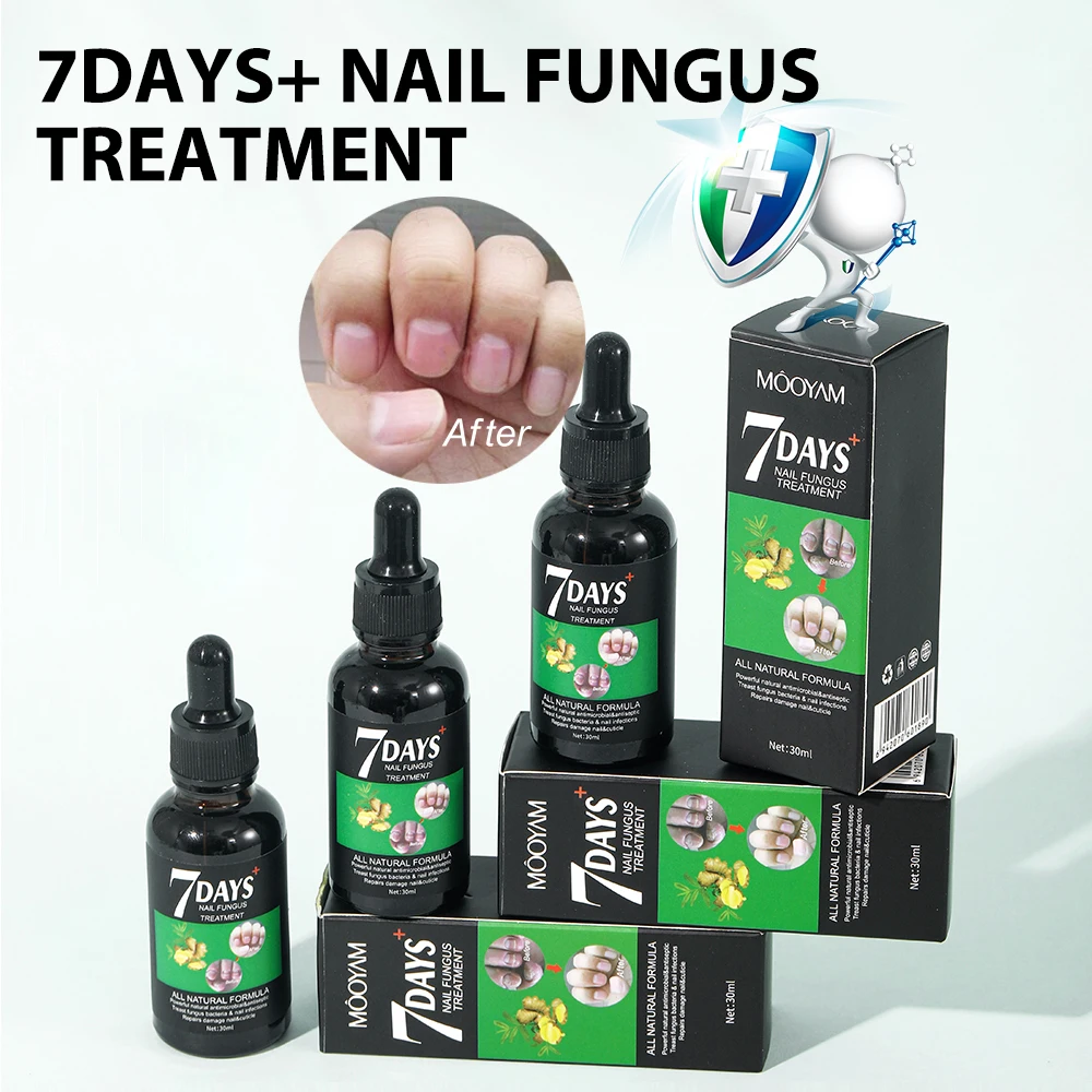 Nail Fungal Essence Ginger Extract Repair Serum Treatment Strengthener Nail For Beauty Glowing Nail