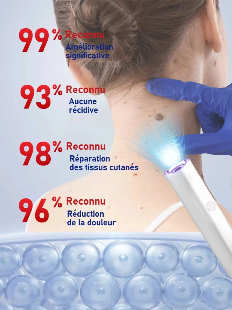 25개의 핫 오툴 워트 블루 라이트, 세트에 대한 추가 할인