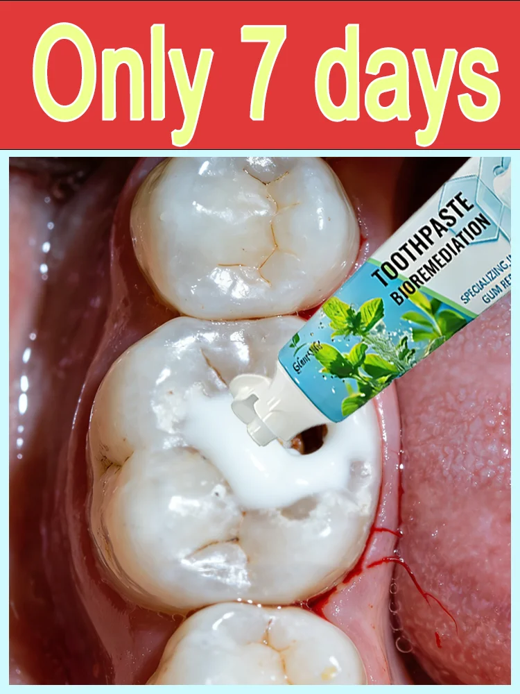 

Mᴜʟᴛɪ-ᴇғғᴇᴄᴛ ᴛᴏᴏᴛʜᴘᴀsᴛᴇ: Cʟᴇᴀɴs ᴛʜᴇ ᴍᴏᴜᴛʜ ᴀɴᴅ ʀᴇᴘᴀɪʀs ᴄᴀᴠɪᴛɪᴇs.