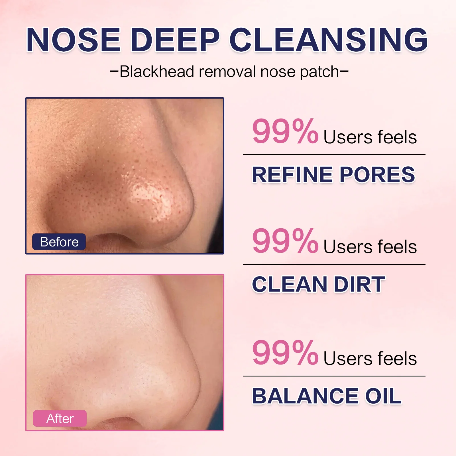 3 stks/doos Mee-eter Neusstrips Roze/Zwart Diepe Reiniging Neusvlek Facial Dot Stickers Neusmasker Shill Voor Acne & Zwart Hoofd