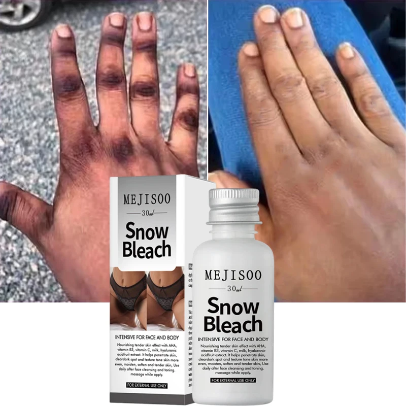 

Fast Whitening Dark Knuckles Brighten Hand Cream Melanin Corrector Moisturizing Intense Stains Remover Products Korean Skin Care