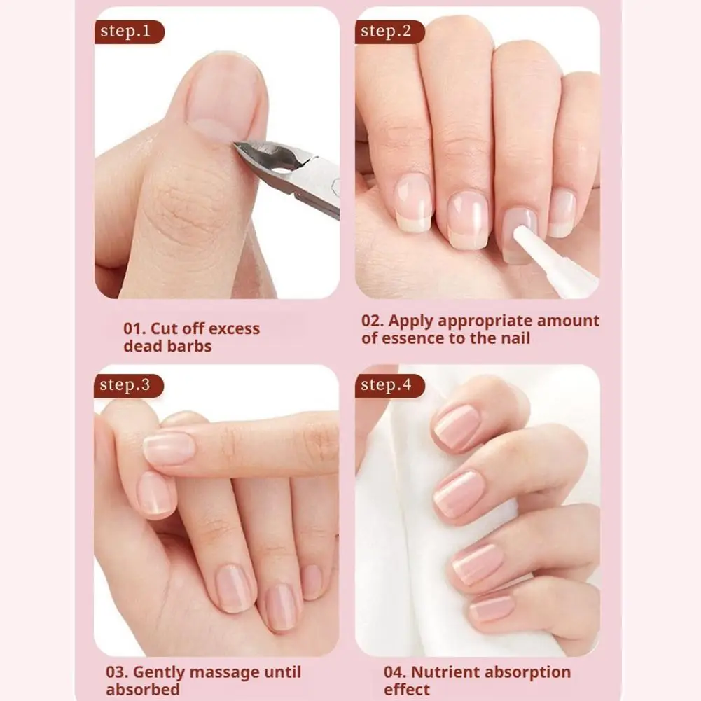 30g Intense Nail Growth And Strengthening Serum 7 Days Nail Growth And Strengthening Serum Nail Strengthener For Thin Nails C5F3