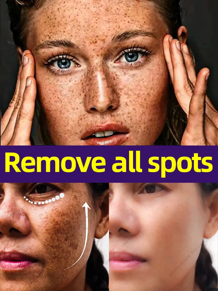 

Say goodbye to all the spot problems