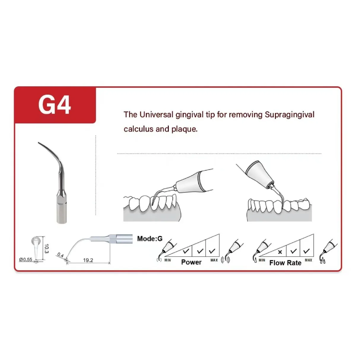 Woodpecker G1/G2/G3/G4/P1 Professional Dental Cleaning and Polishing Tips Set of 5 - High Precision Dental Supplies