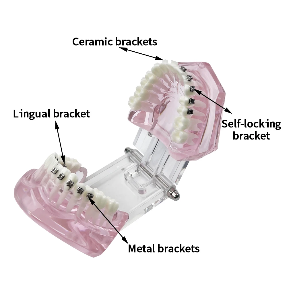 Ortodontyczny Model zębów typodontów z samopodwiązującym się metalowym wspornikiem ceramicznym językowy Model zębów dentystyczny komunikacja