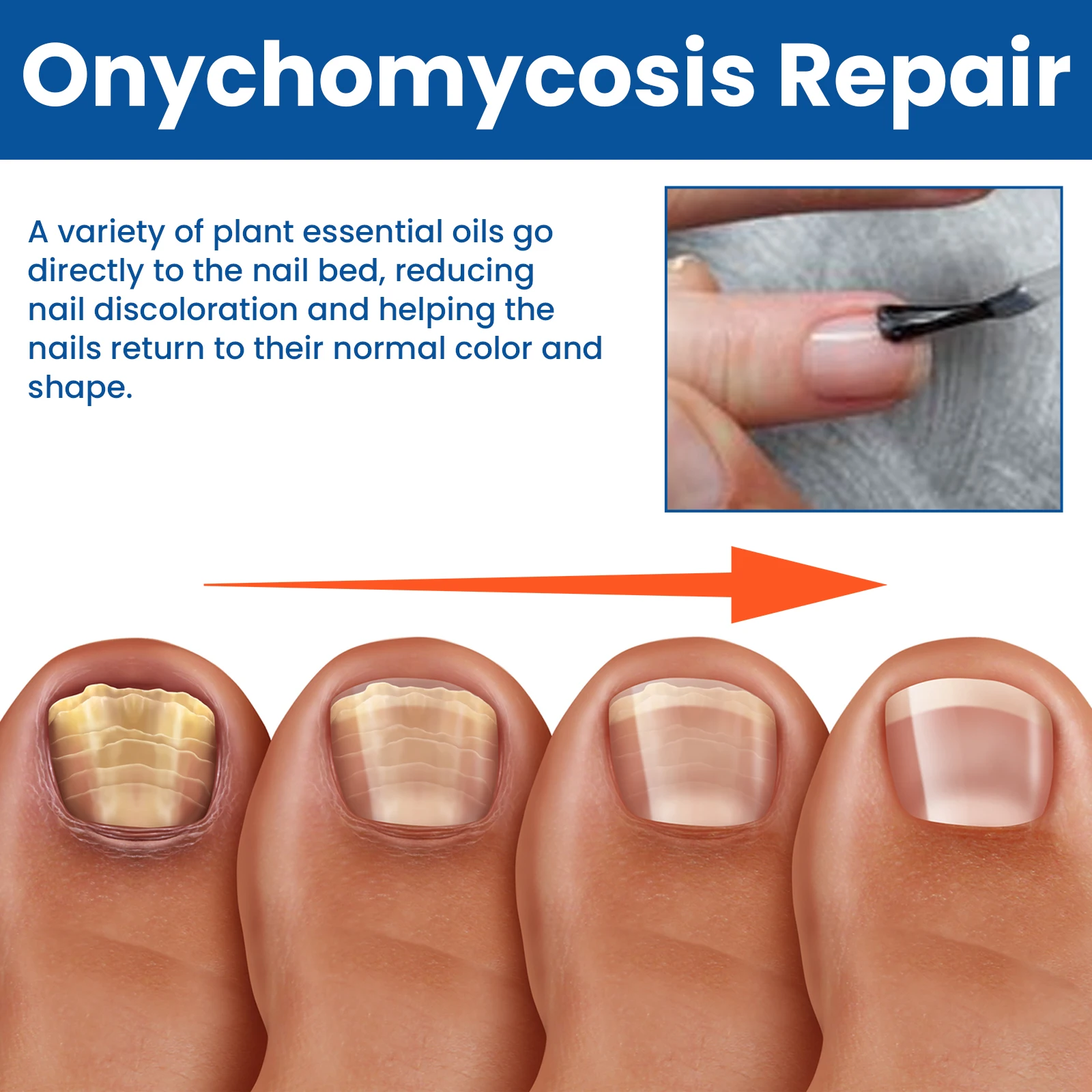 30ml Nail Fungus Repairing Liquid Soothes Softens Moisturizes Nails Deeply Clean Repairs Restores Nail Luster Essential Oils