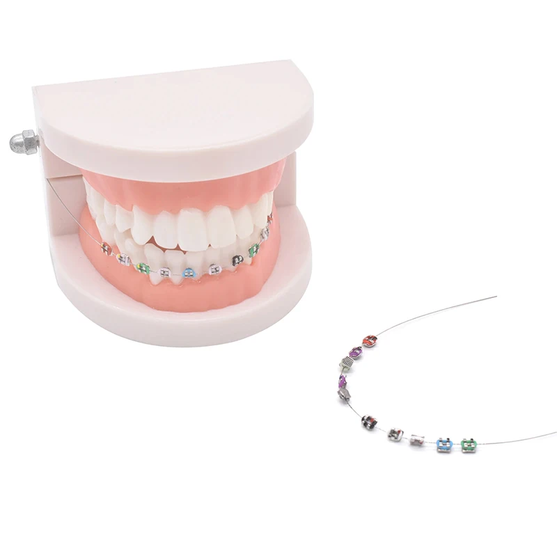 1 Paar Tijdelijke Tanddecoratie Met Metalen Draden Kleurrijke Metalen Beugel En Orthodontische Ligatuurbanden Tanddecoraties