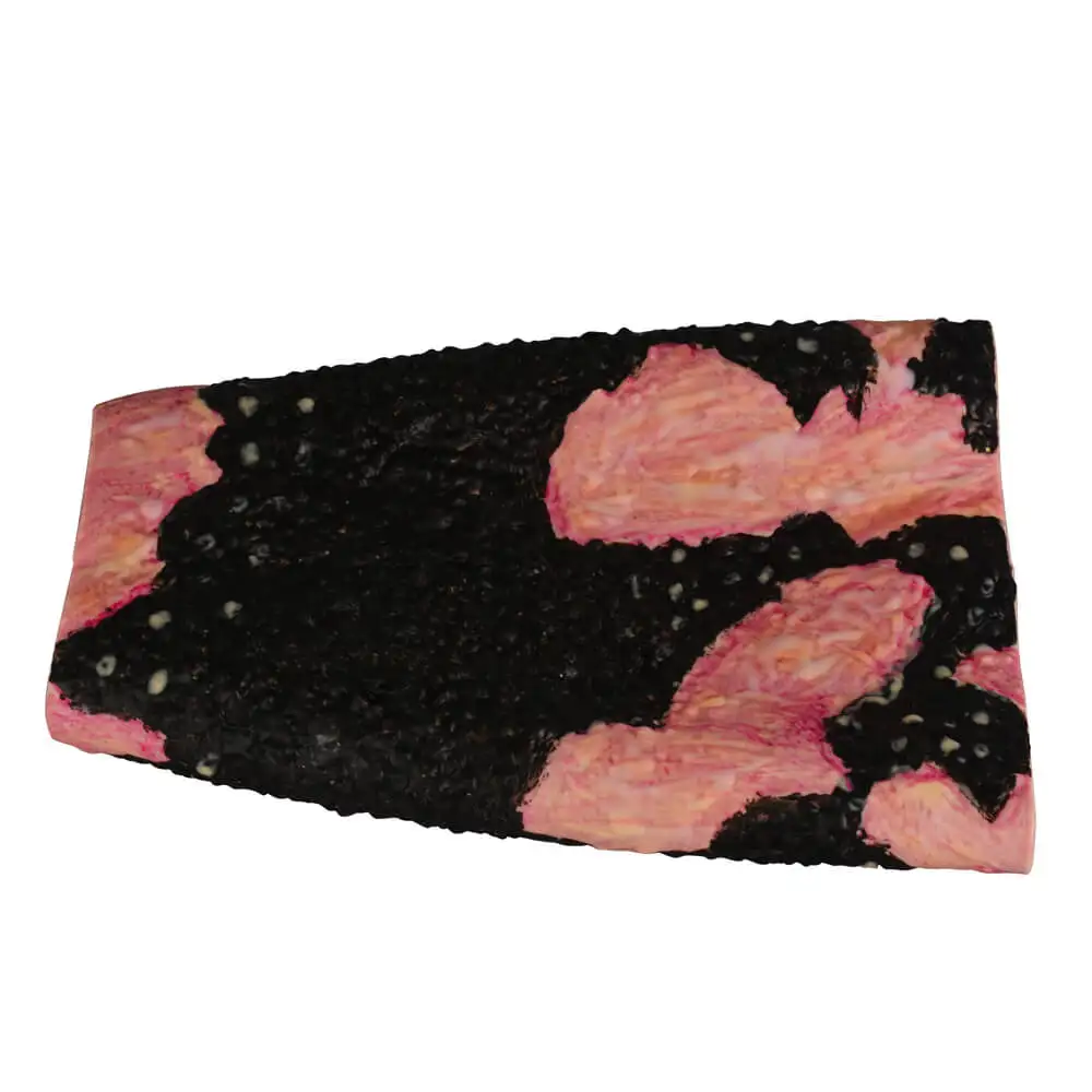 Ultrassist Severe Leg Burn Simulation Sleeve Medical Training Tool for Healthcare Professionals Teaching Education