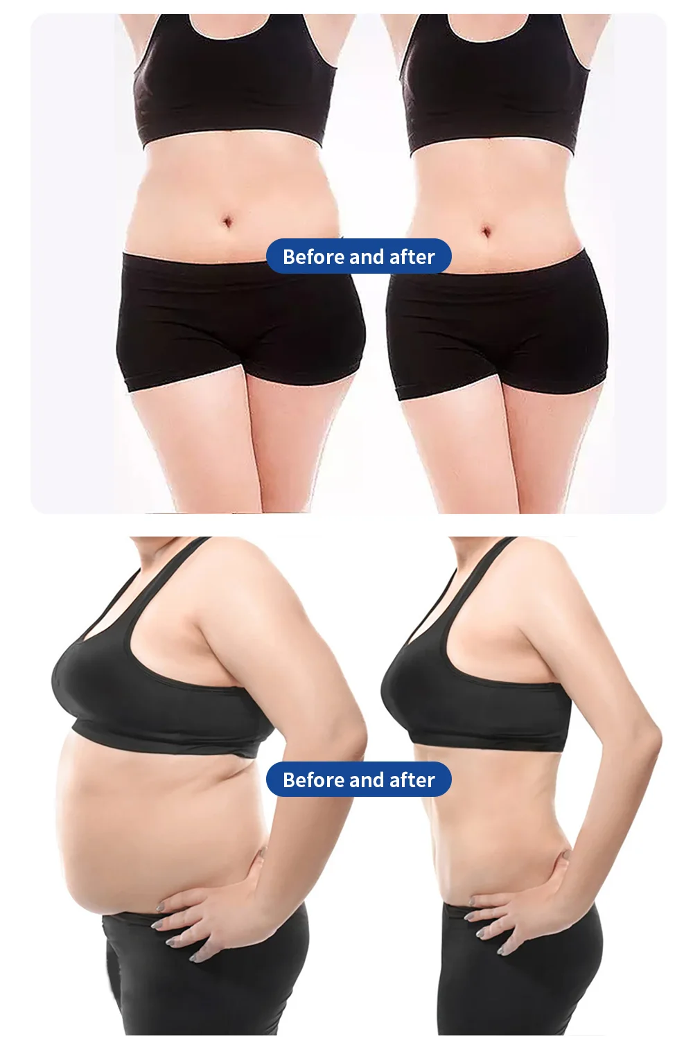 MYOslim Fettreduktions- und Muskelaufbaugerät für Salon-Körperformung, Speziell Entwickelt für Oberschenkel und Gesäß – Detail 8