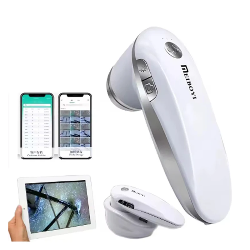 200X بصيلات الشعر كاشف فروة الرأس تطبيق لاسلكي واي فاي محلل الجلد الرقمي المجهر أداة عالية الوضوح جهاز اختبار الجلد 2026 جديد