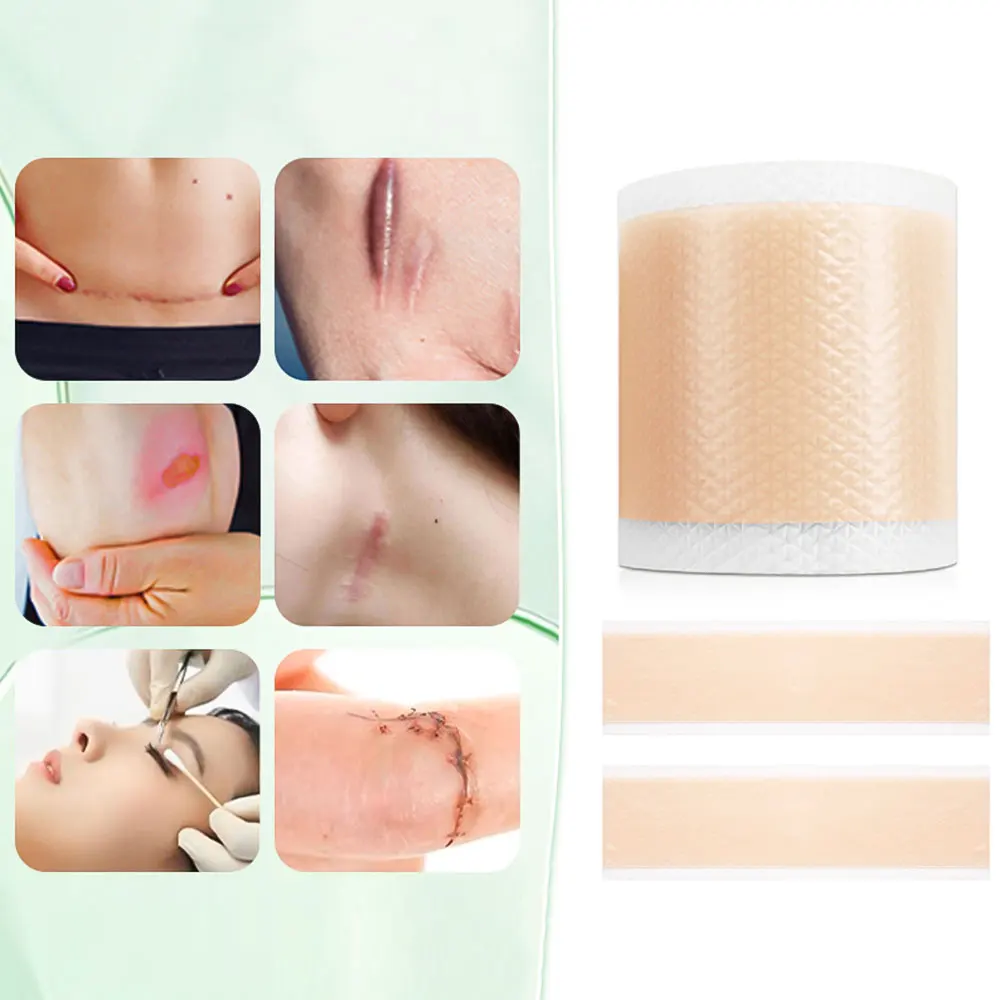 4 سنتيمتر * 50 سنتيمتر ندبة ورقة إزالة قطاع الطفل الأذن مصحح هلام السيليكون ندبة التصحيح قطاع لحب الشباب كيلويد جراحة حرق العلاج #6