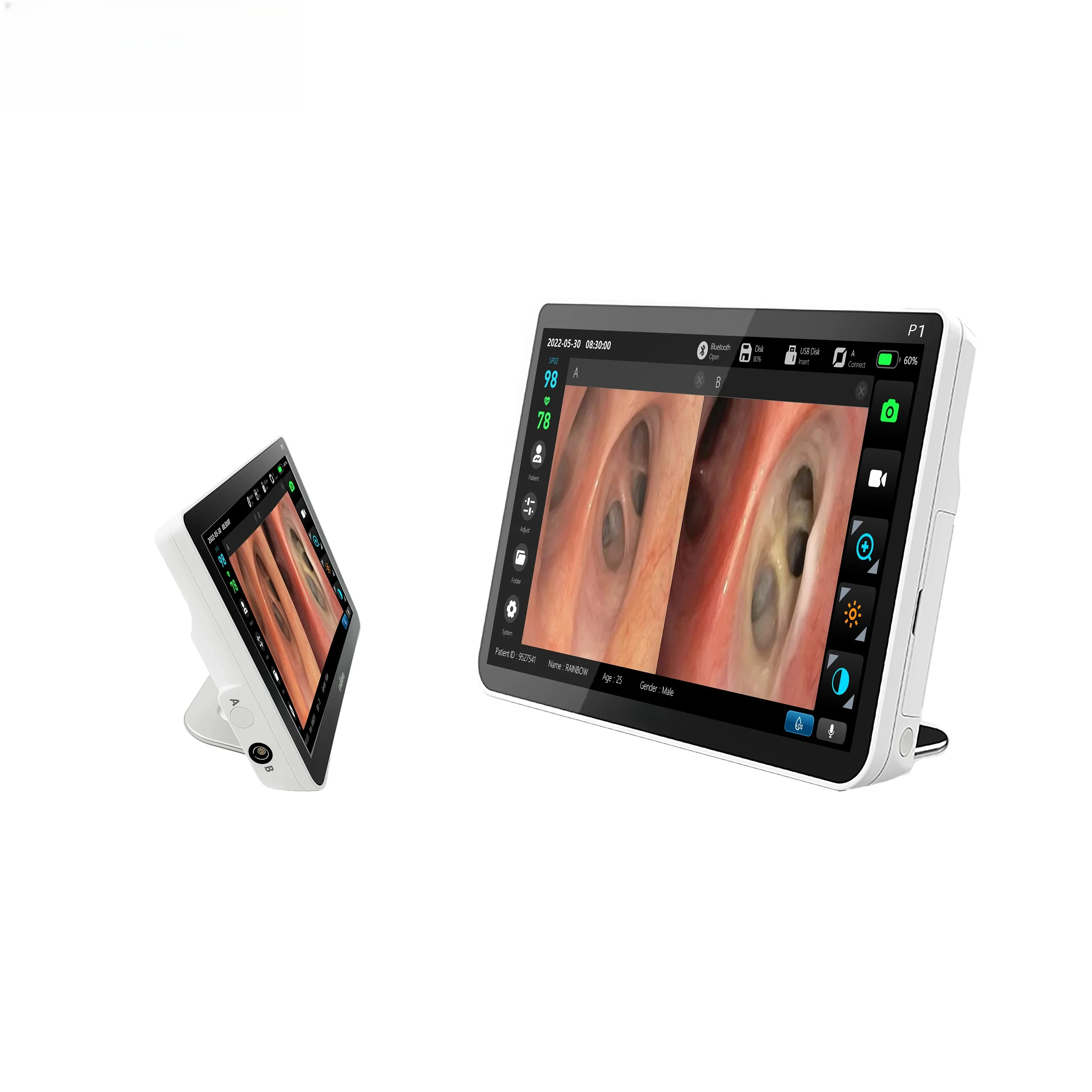 

12.1Inches High Quality Multi-Function ENT Portable HD Portable Medical System with