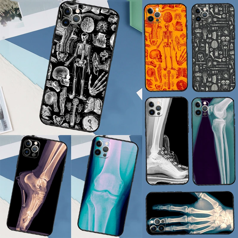 Чехол X-Ray Human Anatomy для Honor Magic 7 Pro 6 5 Lite, чехол для Honor 200 400 90 70 50 X9 X8a X8b X9a X9b X9c