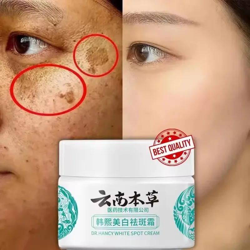 High-quality Niacinamide Melasma Brightening Cream Reduce Melanin Brighten Cream Lighten Dark Skin Chloasma Serum Face Skin Care
