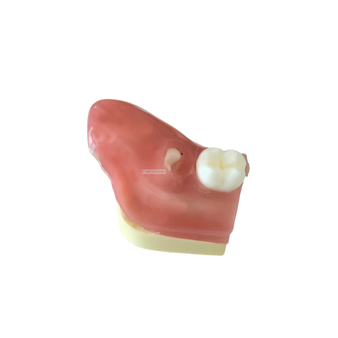 Picture 6: M8026 Impacted Wisdom Tooth Extraction Training Model Dental Tooth Model Oral Teaching Replaceable Base