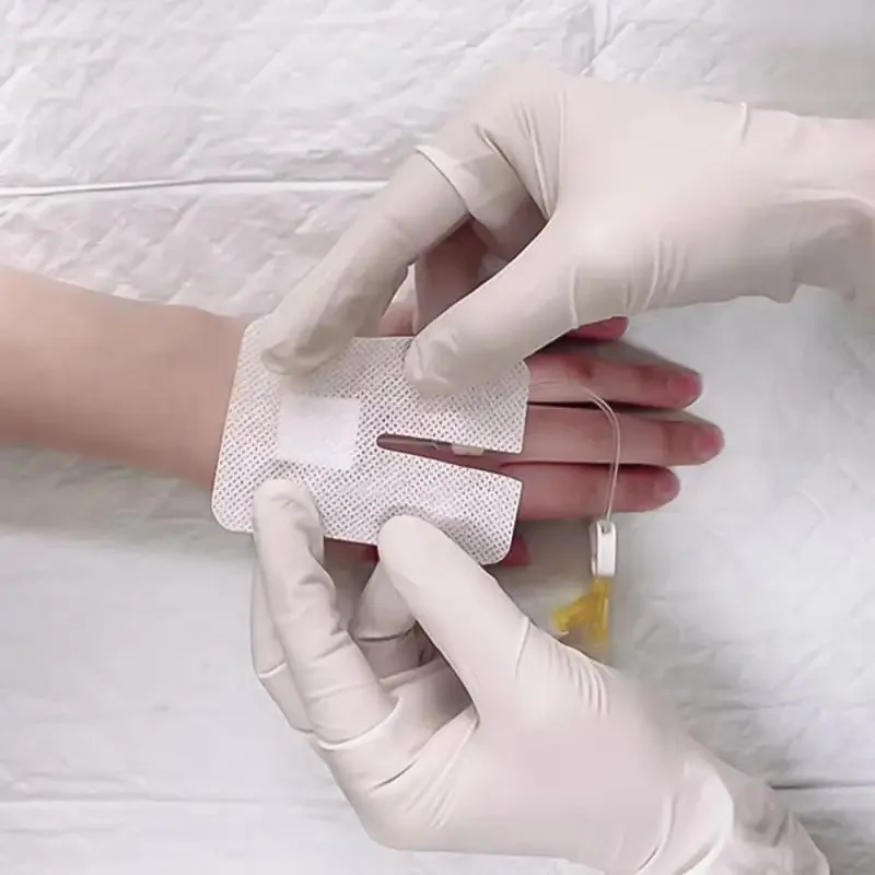 แผ่นปิดแผลชนิด U ขนาด 6*8 ซม. จำนวน 5/10/15 ชิ้น แบบไม่ต้องผ่าตัด ไม่ใช่แบบปลอดเชื้อ สำหรับปิดท่อฉีดยา IV ชนิดฟิล์มไม่ทอ