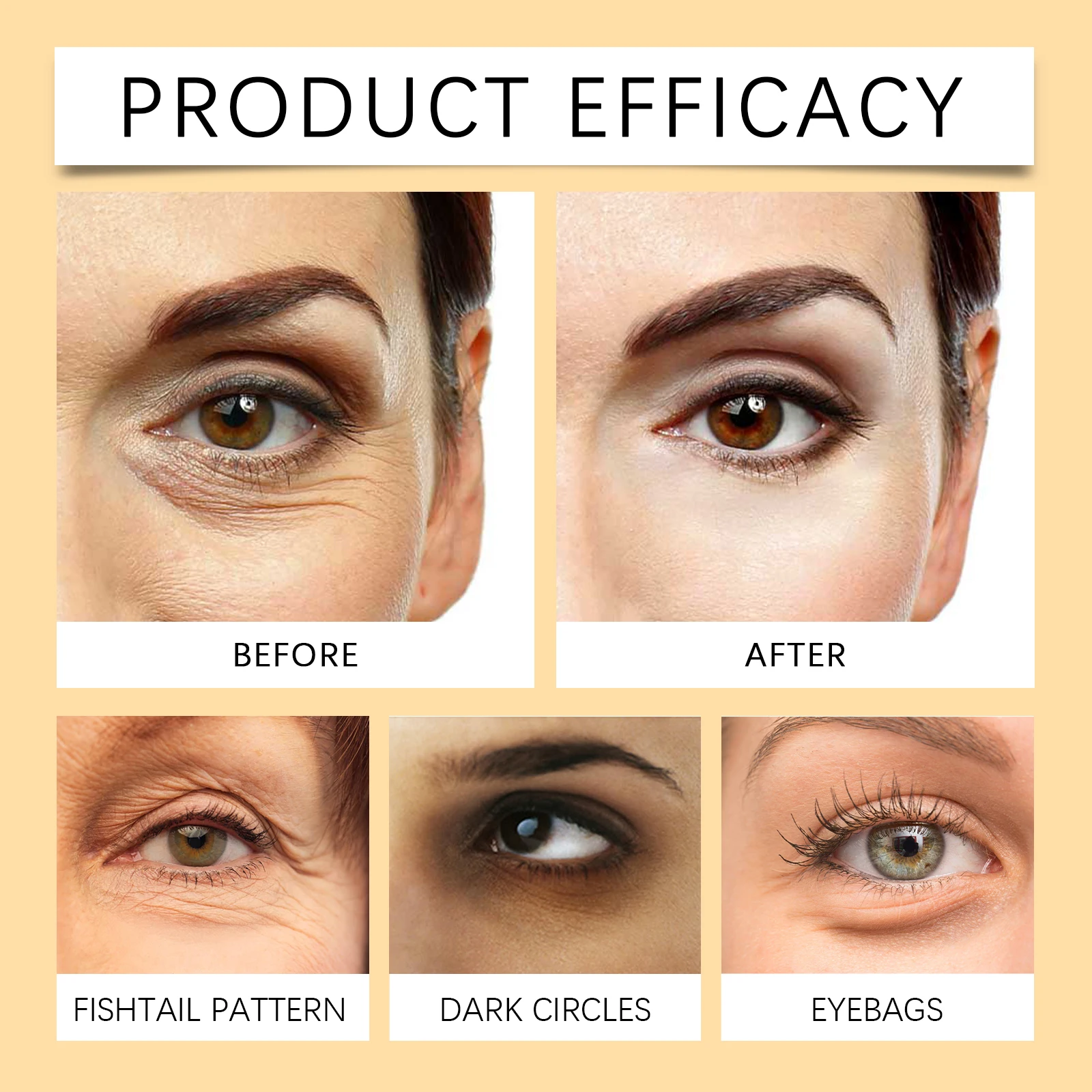 مجموعة العناية بقناع عين الكولاجين من سم النحل 50 مل + 10 قطع مرطبة تحت العين علاج العين القابل للذوبان للهالات السوداء ومكافحة الشيخوخة