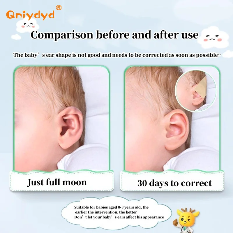 1 Roll Baby Ear Corrector Infant Protruding Ears Correction 4 X 50cm Silicone Kids Ear Aesthetic Correctors Patch Sticker