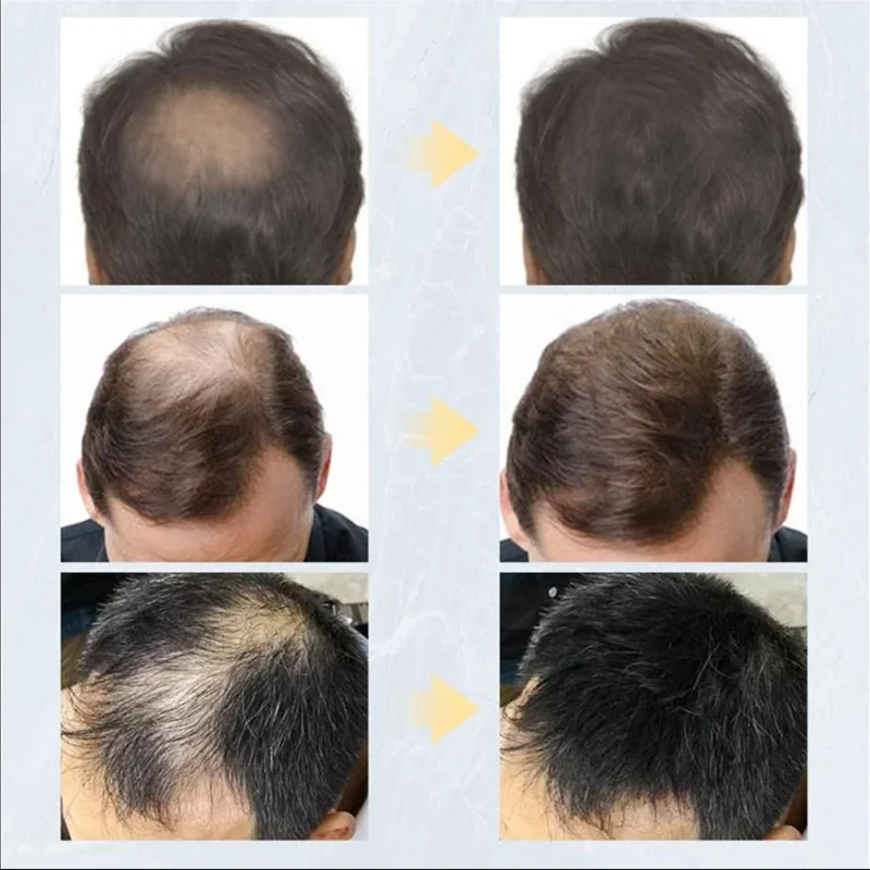 Serat rambut aplikator Keratin serat bangunan rambut pompa semprot bubuk penumbuh kembali instan bubuk rambut penutup 27.5g