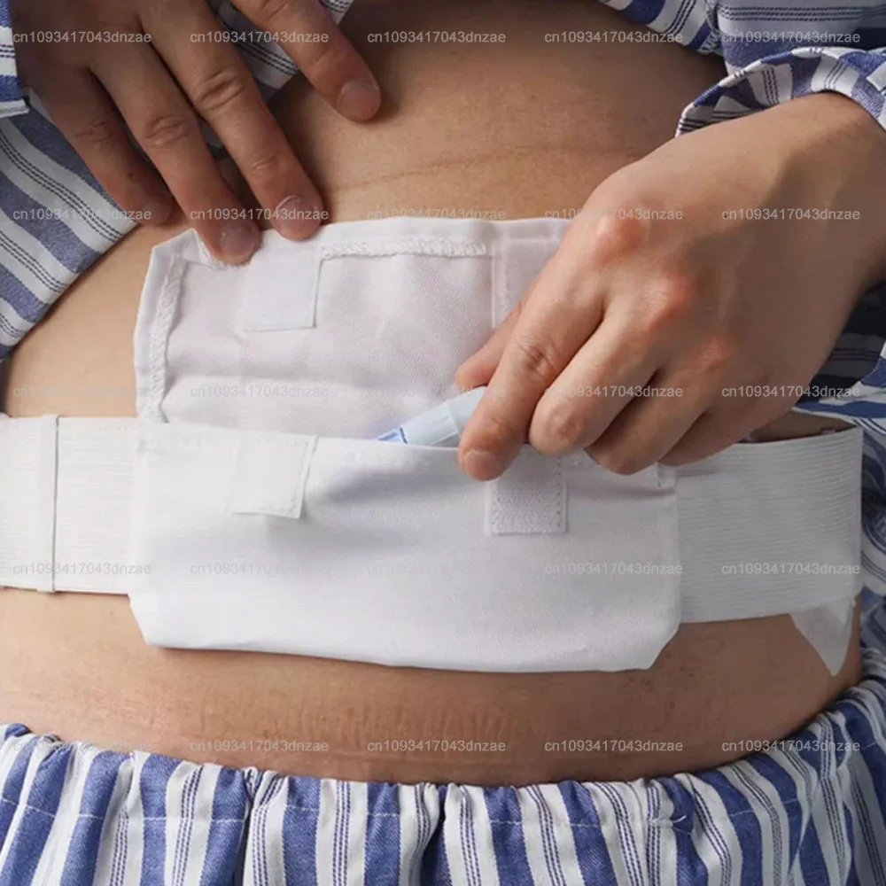10pcs Cotton Belt Peritoneal Dialysis Catheter Fixation Device Stretchy Breathable Abdominal Protector Holder Accessories