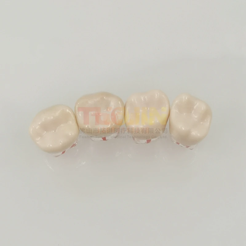 5pcs Dental Endodontic Teeth Practice Model Training Root Canal Files Study Blocks Resin RCT Demo Student Dentistry Teaching