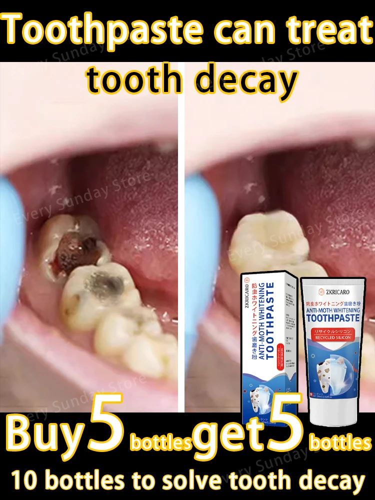 tooth decay