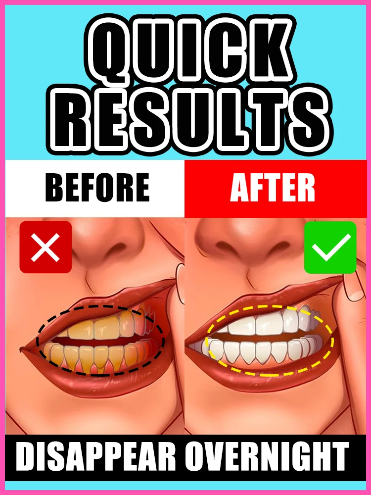 

Probiotic Mint Sp8 Fresh Breath Remove Plaque Stain Keep Brighten Reduce Yellow for Smoker Teeth dental Care