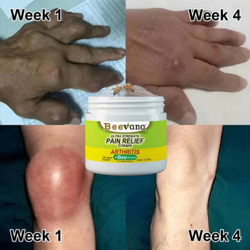 Beevana New Zealand Joint Relief Cream Joint and Bone Therapy Cream Knee Muscle Arthritis Treatment Gel Body Massage Care