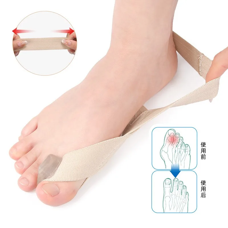 من جانب واحد سحب الورم الجبيرة ليلا ونهارا قابلة للأحذية بيج فوت تداخل فاصل أصابع القدم حزام التوتر الملابس #2