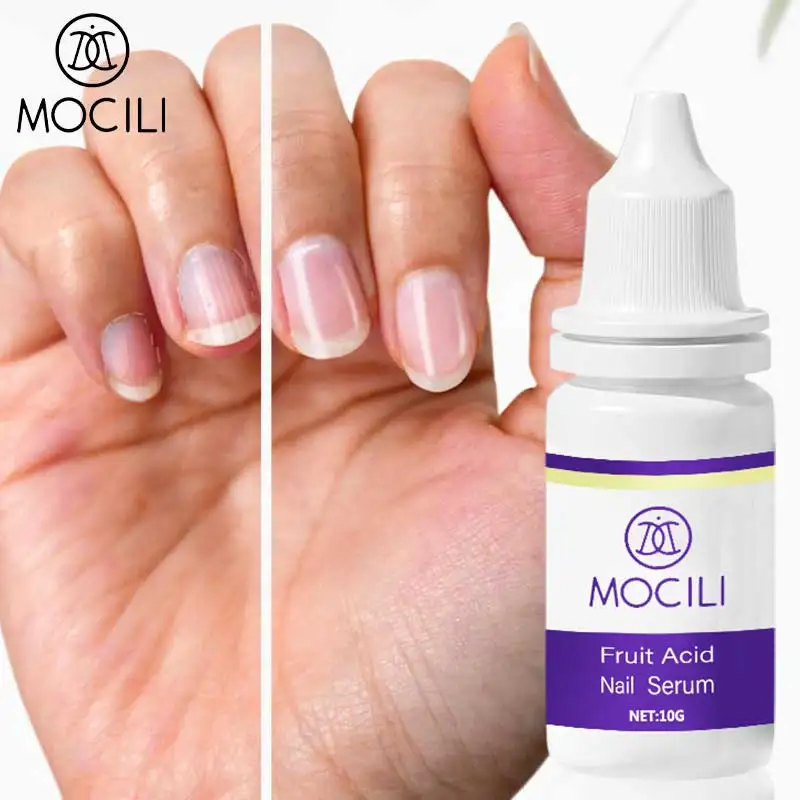 Fruit Acid Nail Serum Promotes Nail Growth By Protecting From Physical Damage Smooth And Moisturize Nails Nail Care 10ml