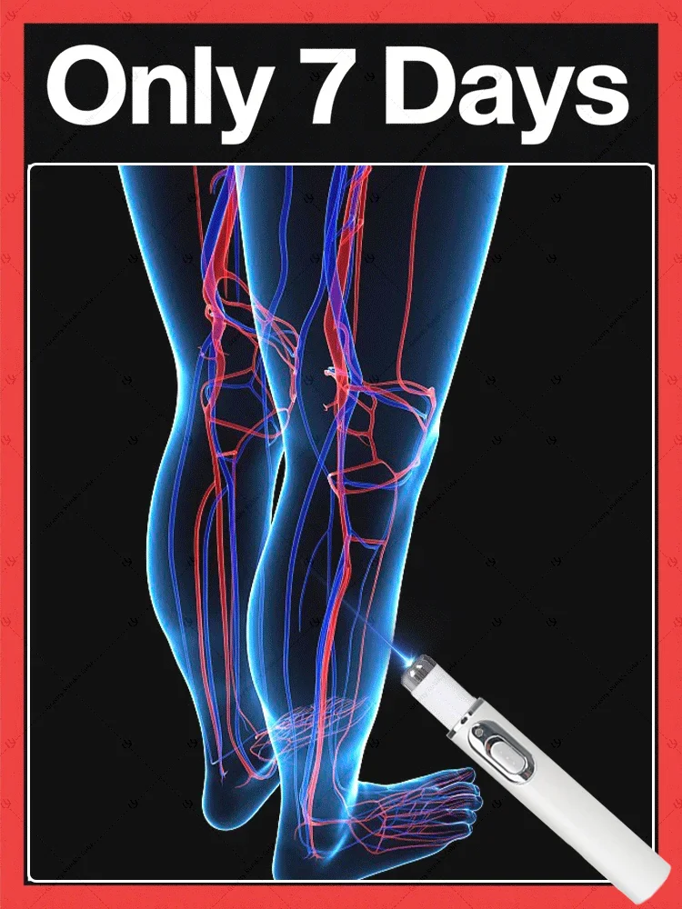 

blue light pen solve ᵥₐᵣᵢcₒₛₑ ᵥₑᵢₙₛ,2025 NEW hot sale leg care tools
