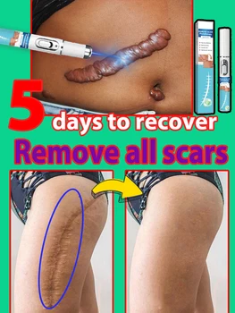 Produtos para cicatrizes