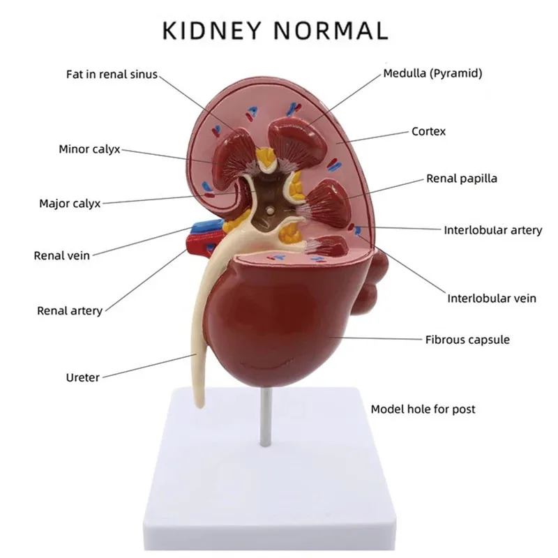Anatomy Human Normal and Pathology Kidney Anatomical Model Diseased Kidney Urinary System Organ Medical Teaching