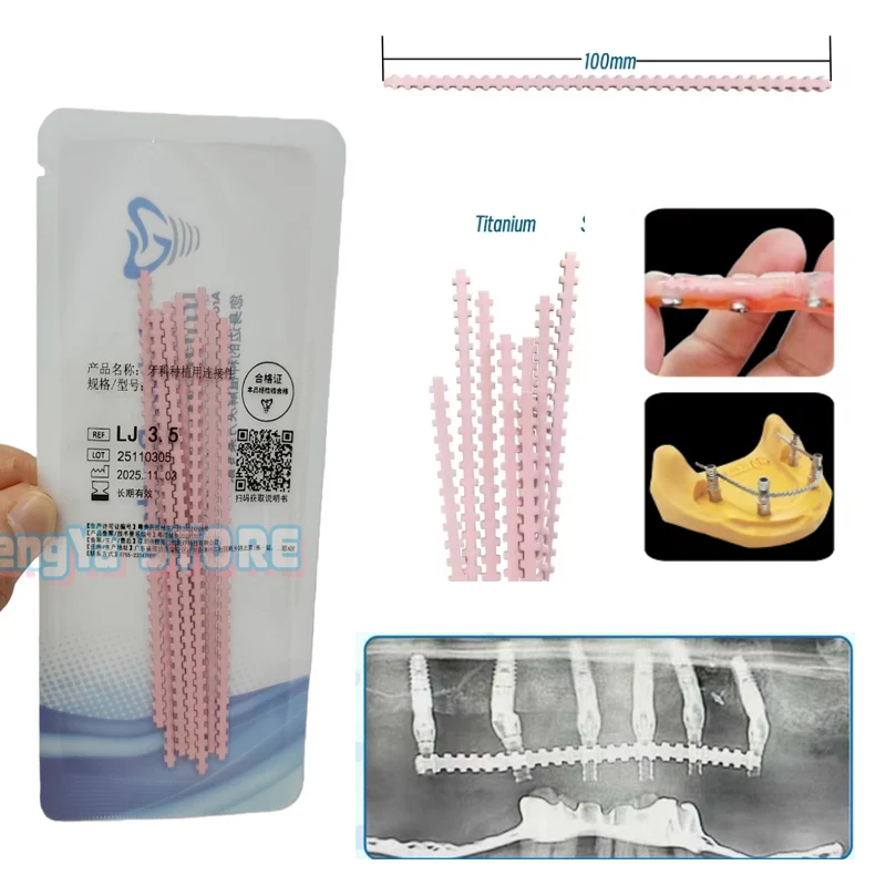 5 Pieces Dental Pink Strengthener Wires Implant Connector Titanium Wire Overdenture MU Wires