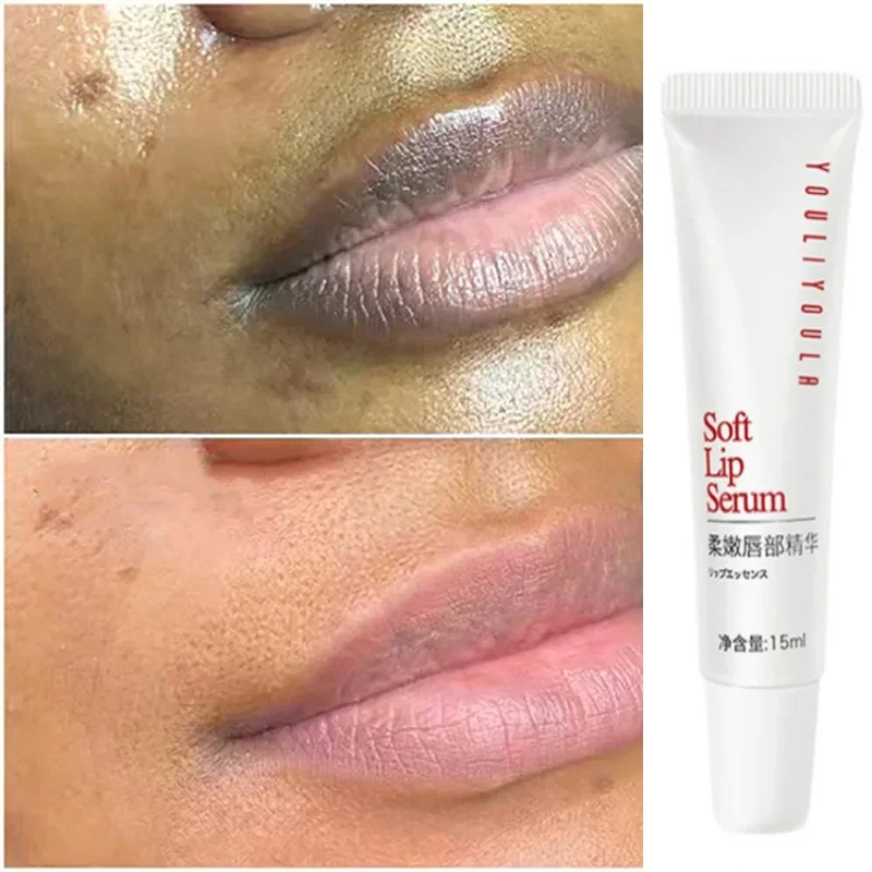 Lippen Roze Frisse Bliksembleekcrème Behandeling Verwijderen Donkere Rook Lippen Lippenbalsem Whitening Huidherstel Lipverzorging Voedende