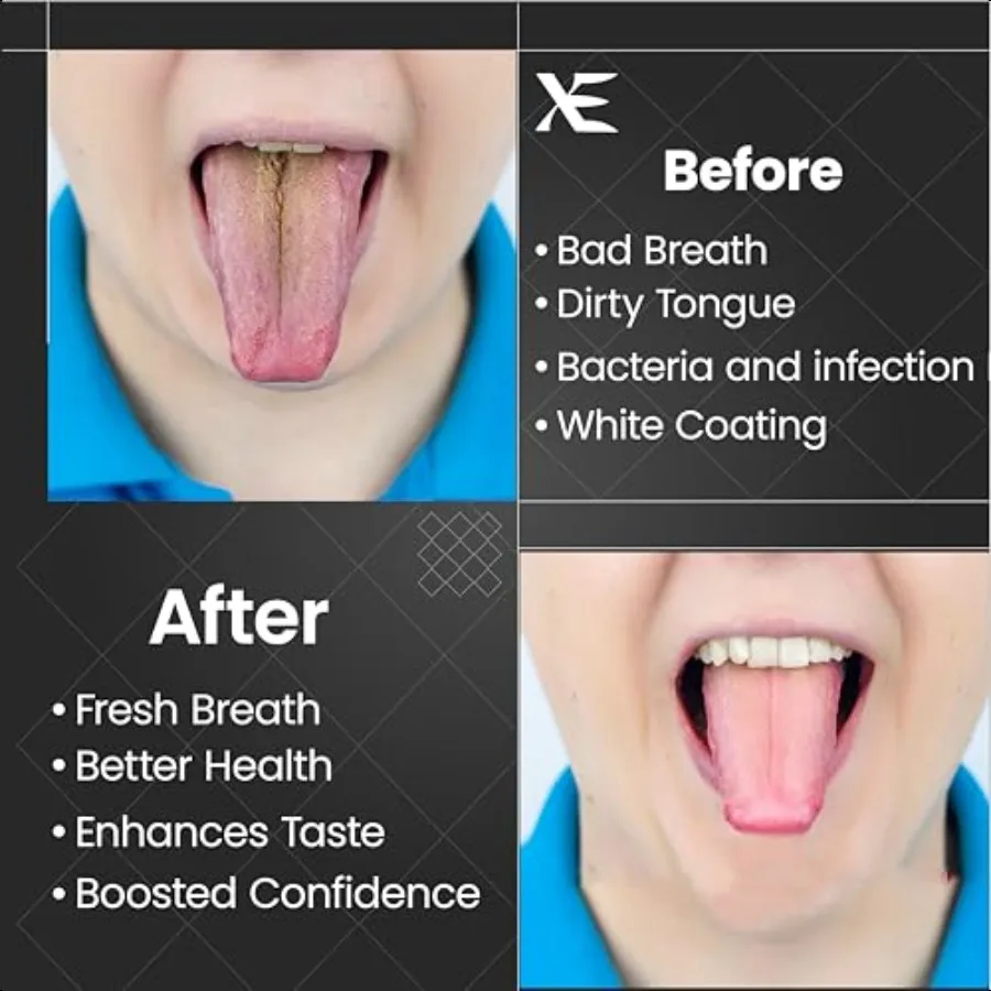 XE 2 قطعة مكشطة اللسان Y شكل الفولاذ المقاوم للصدأ مكشطة اللسان المعدنية لعلاج رائحة الفم الكريهة منظف اللسان للرجال