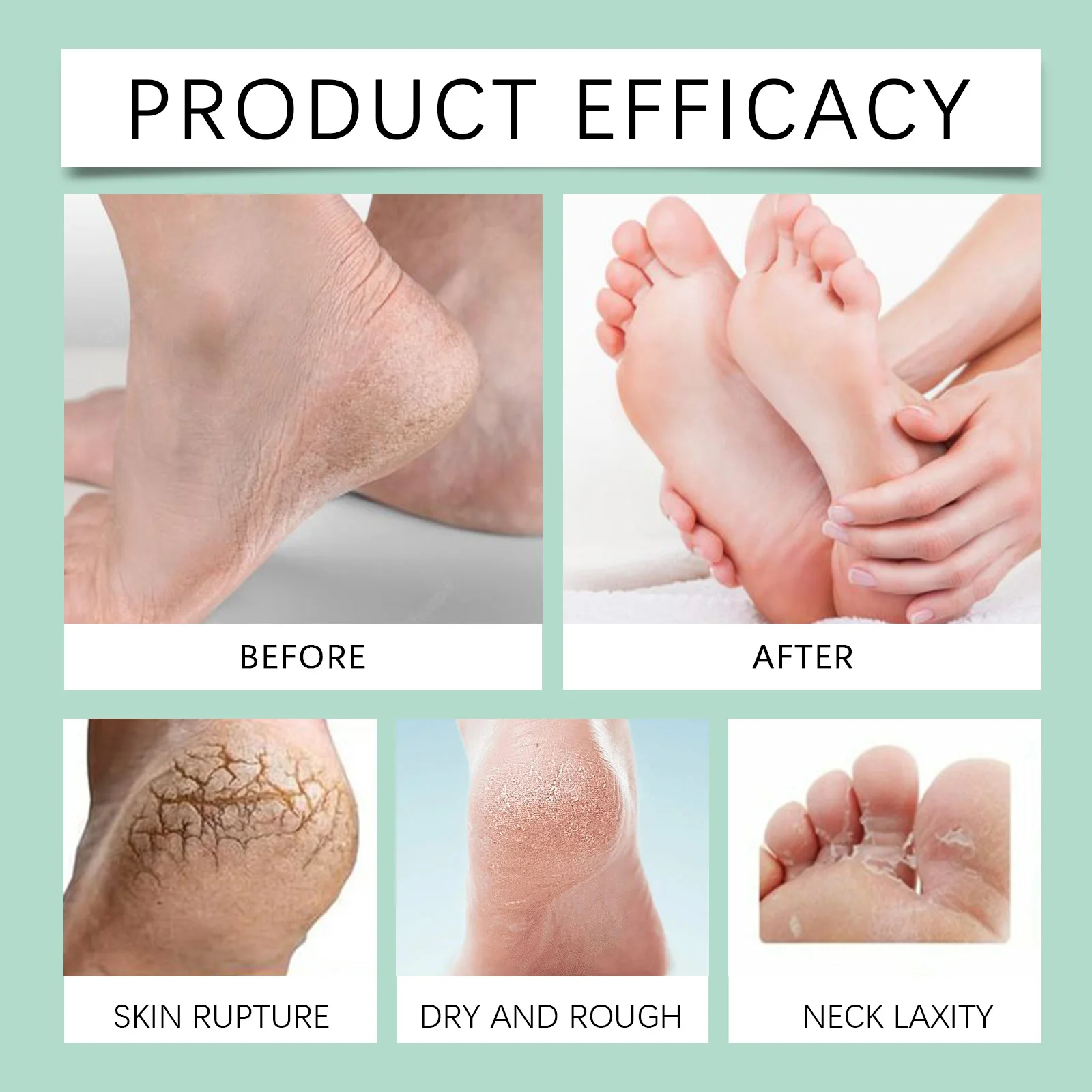 100ml Foot Cuticle Remove Dead Foot Exfoliator Softener Remove Dead Skin And Calluses Foot Moisture Spray Peeling Moisturizing view 4