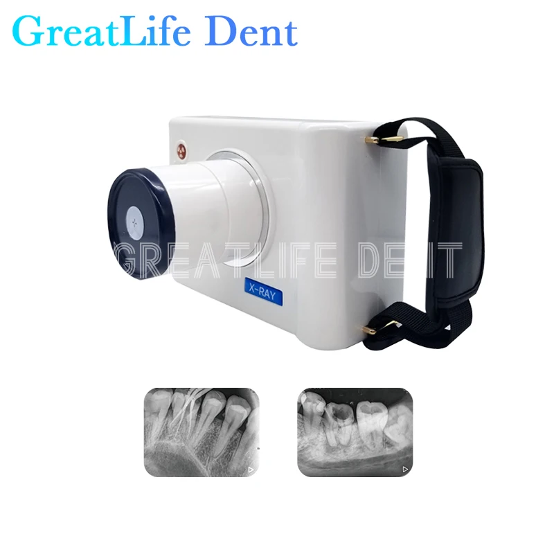 Portable Handheld Dental X Ray Machine LED Screen 200mm High Frequency RVG Image Sensor System Dental X-Ray Camera