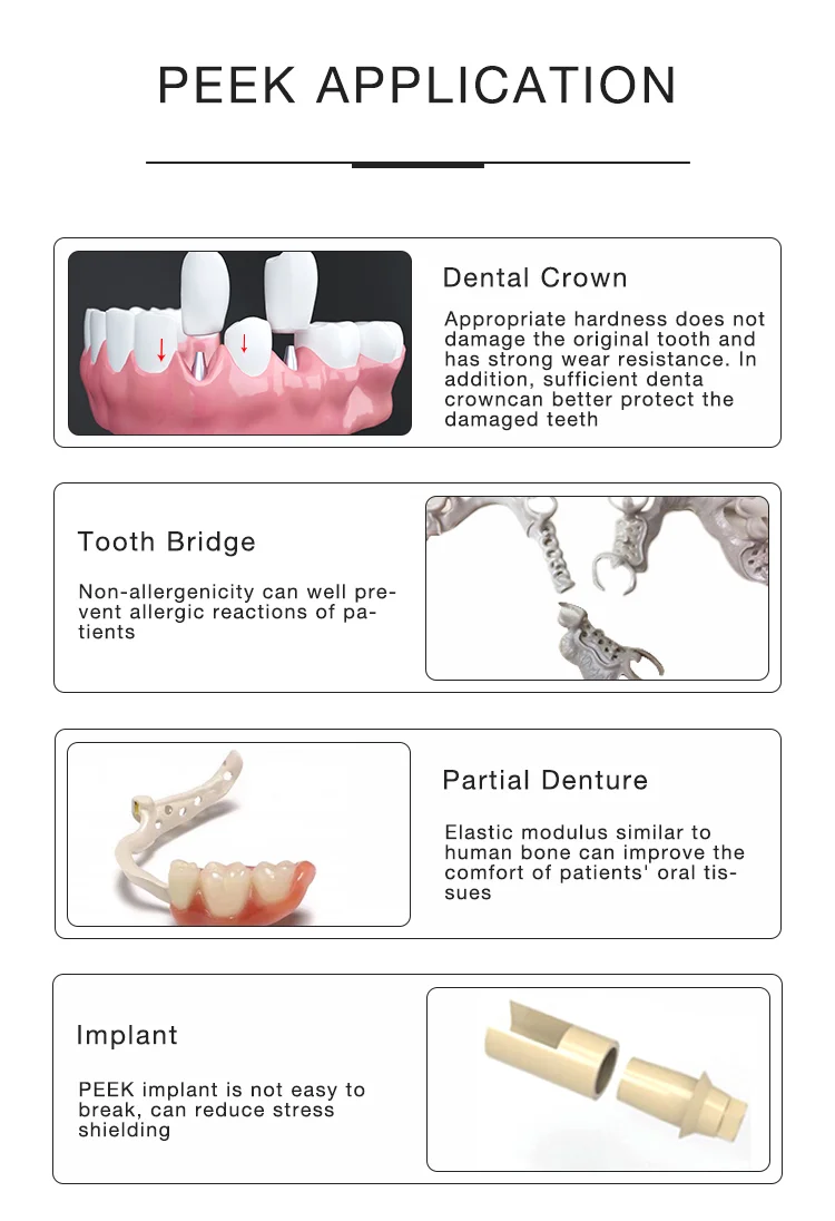 Lodden Dental Labor PEEK Block 98mm Naturgelb Gingivalweiß für CAD/CAM Schnitzarbeiten Dentallabormaterialien – Detail 4