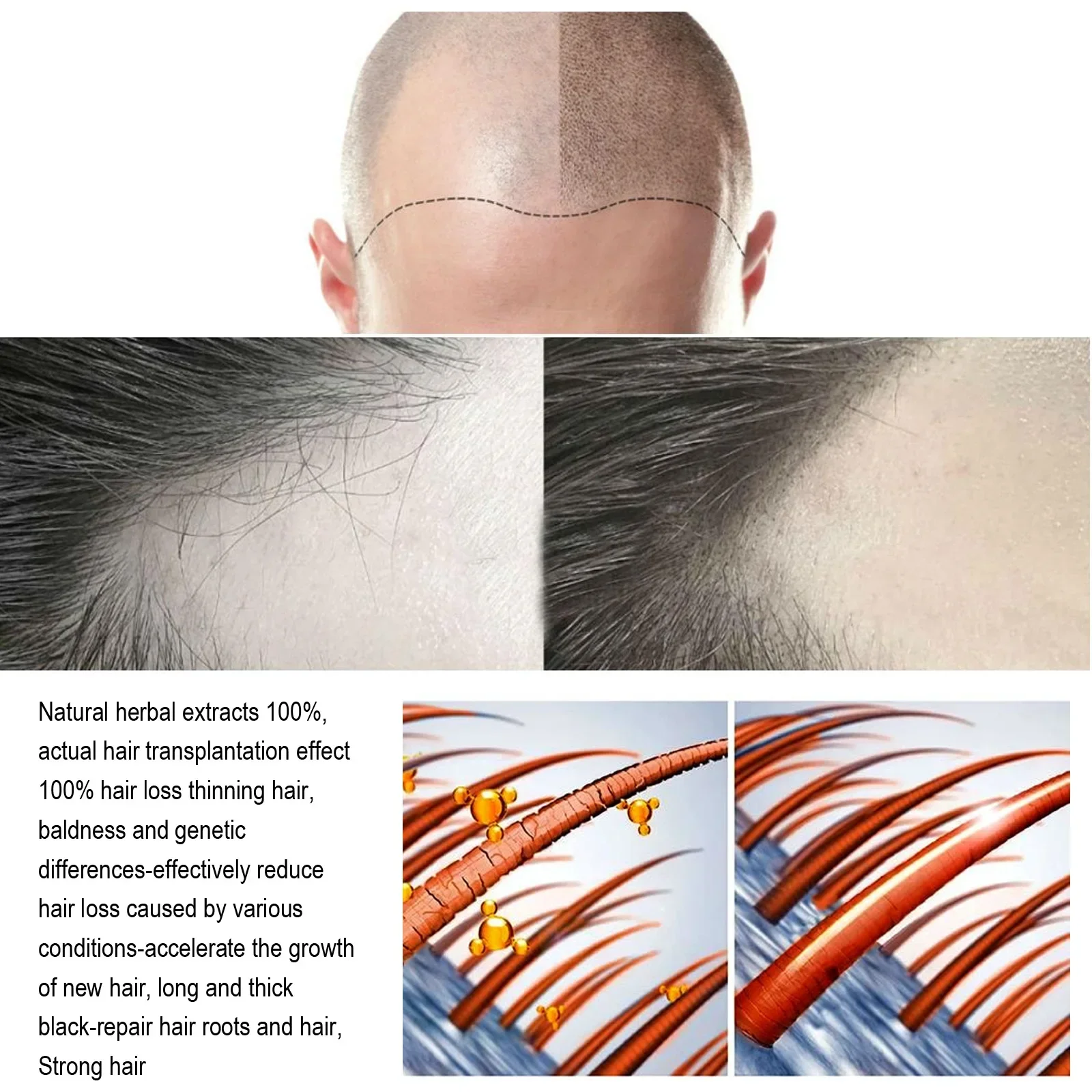 Sdotter New Unisex Hair Growth Oil Hair Loss Treatment Rapid Hair Growth Effective Baldness Repair Stress Postpartum Scalp Damag