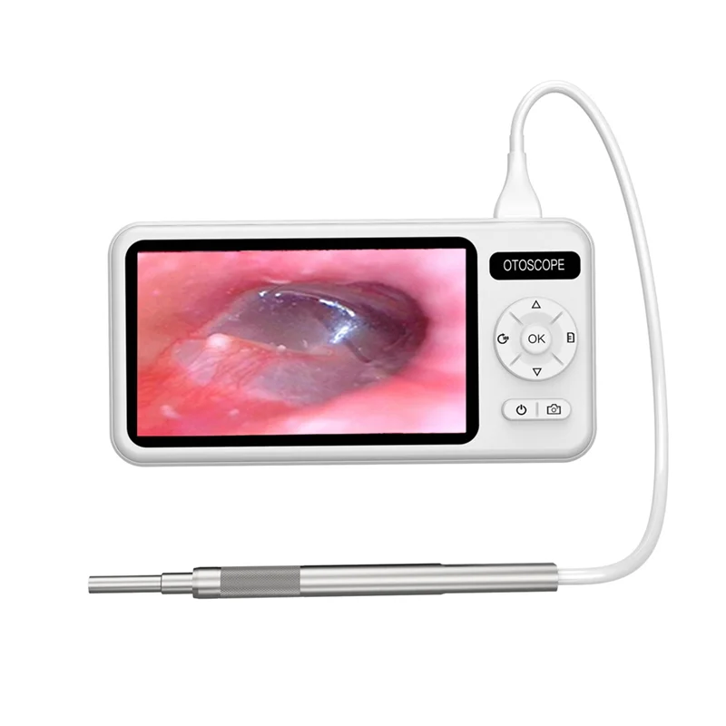 

A63X-Digital Otoscope, In-Ear Camera, Earwax Removal Tool, Visual Ear Spoon Supports Photo Snapshots Ear Cleaner