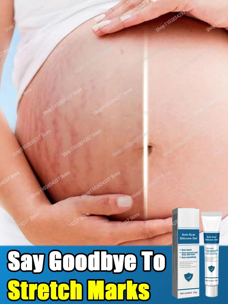 Pregnancy Stretch Marks Removal Cream