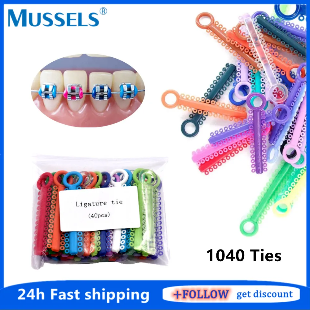 1040-pcs-dental-ortodontico-elastico-ligadura-lacos-bandas-para-suportes-dentes-cintas-de-borracha-colorida-anel-tratamento-odontologia