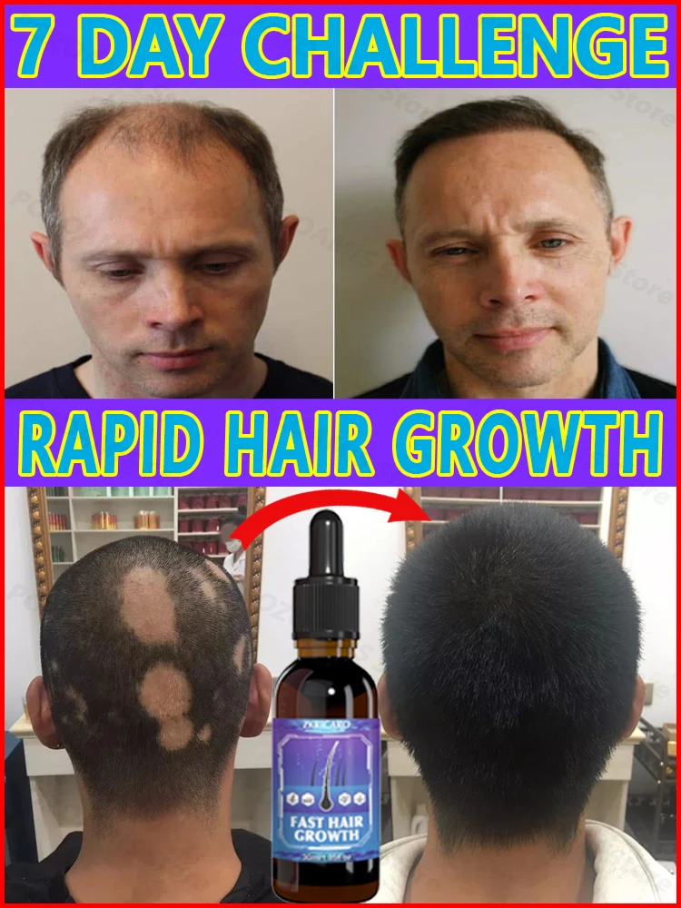 

Save your hair