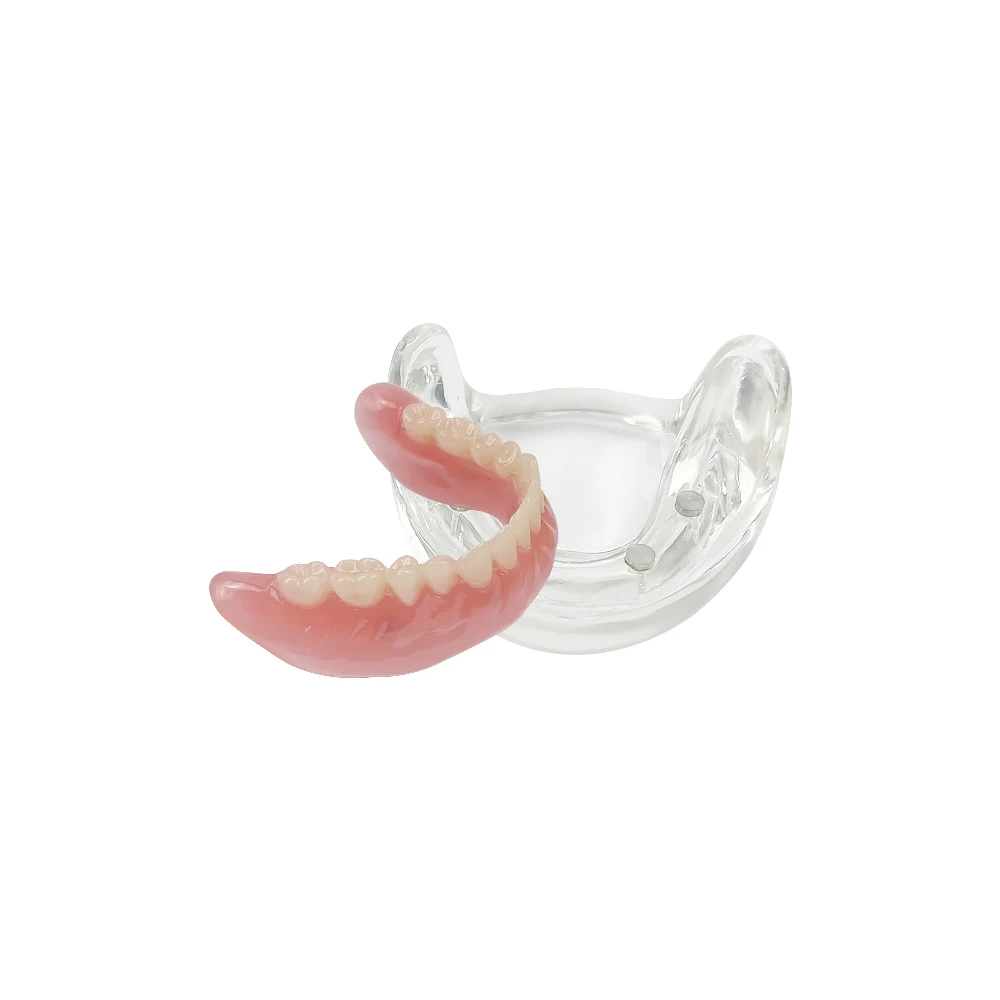 Mandibular Dental Teeth Model 4 Implant Restoration Models For Patient Education Removable Bridge Dentistry Lower Overdenture