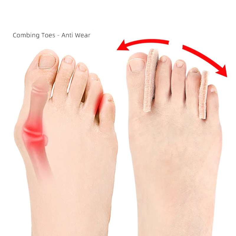 1/10/100Piece Hallux Valgus Splitter Toe Spacer Overlapping Fingers Pedicure Separator Corrector Pain Relif Foot Care Correction view 5