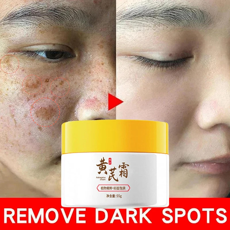 Astragalus Facial Whitening Moisturizer,Freckle Removal Cream, Face Dark Spots Melasma Melanin Remover,Skin Brighten Repair Care