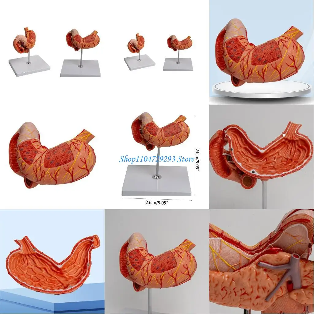 

Y2GD Human Stomach Anatomy Model, Life Size Anatomical Stomach Model Organs Teaching Aids, Human Stomach Anatomy Model