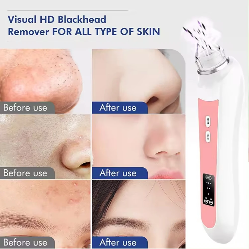 6 Heads Pore Cleaner Blackhead Remover Vacuum with Camera Face Acne Pimple Extractor Facial Nose Skin Care Tools