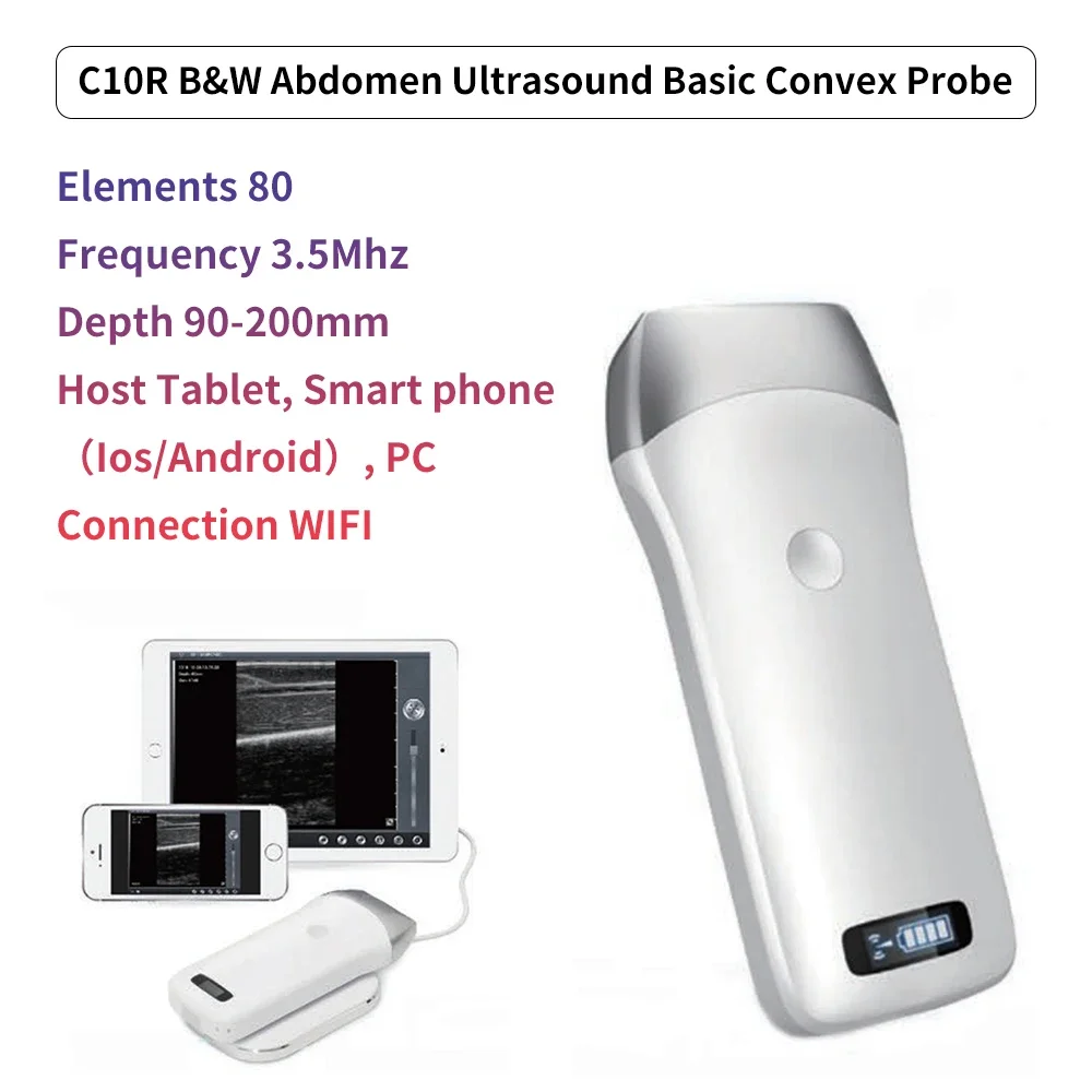 Portable Wireless Ultrasound Convex Probe Scanner Machine with Aluminium Box Support IOS Android Windows